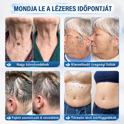 🌟HISKIN®👩‍⚕️ 7 napos bőrcimpa- és folteltávolító fájdalommentes, heg nélküli fejlett bőrhibakezelő görgős toll