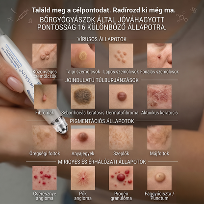 🌟HISKIN®👩‍⚕️ 7 napos bőrcimpa- és folteltávolító fájdalommentes, heg nélküli fejlett bőrhibakezelő görgős toll