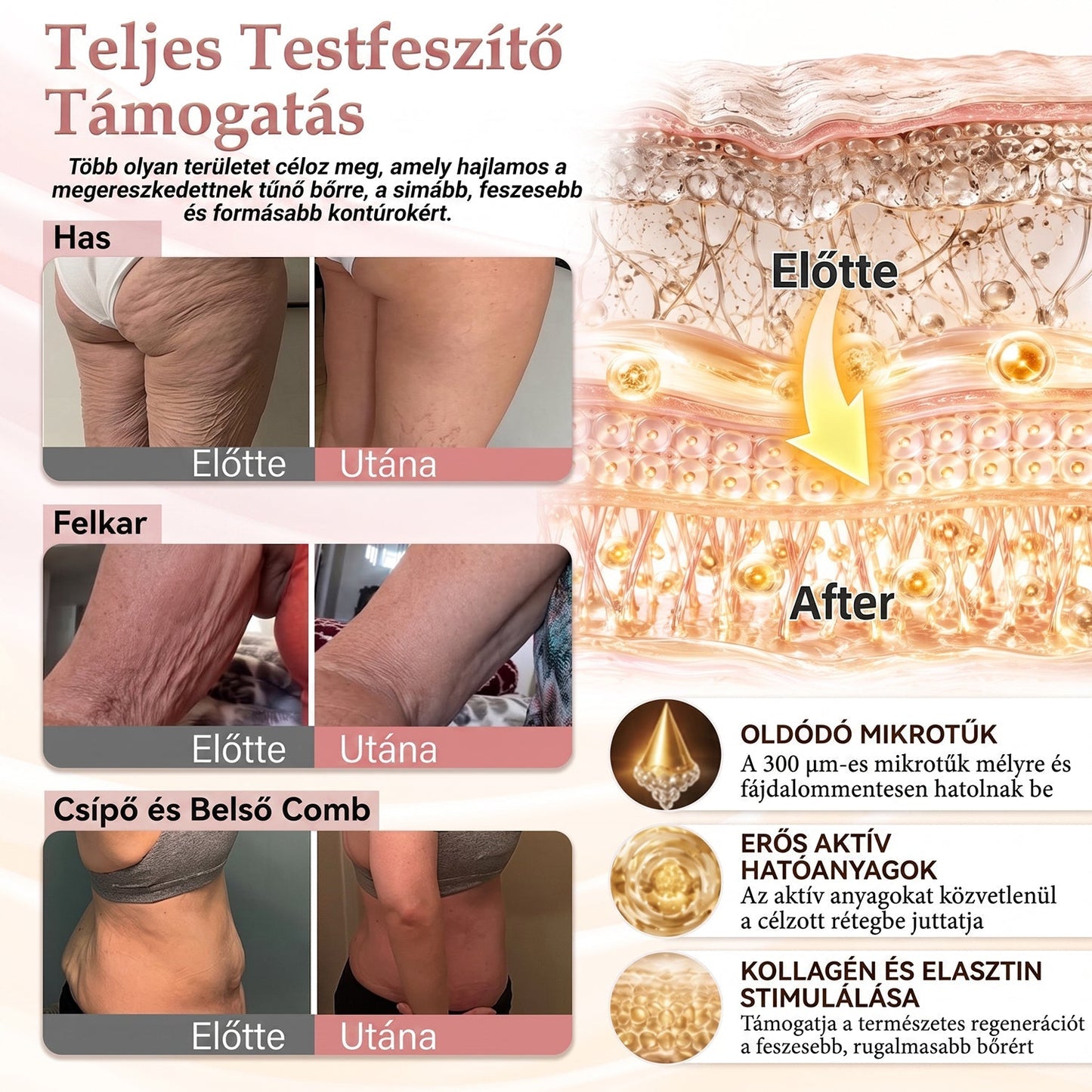 🌟HISKIN® MELLEMELŐ ÉS FESZESÍTŐ MIKROTŰS TAPASZOK